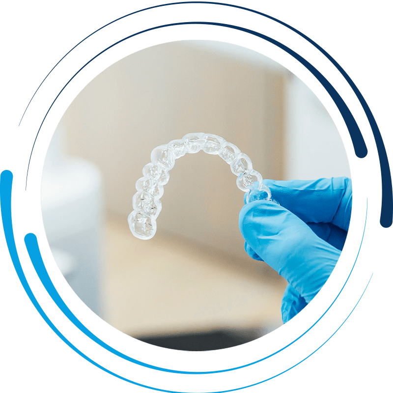 aligner clear 1