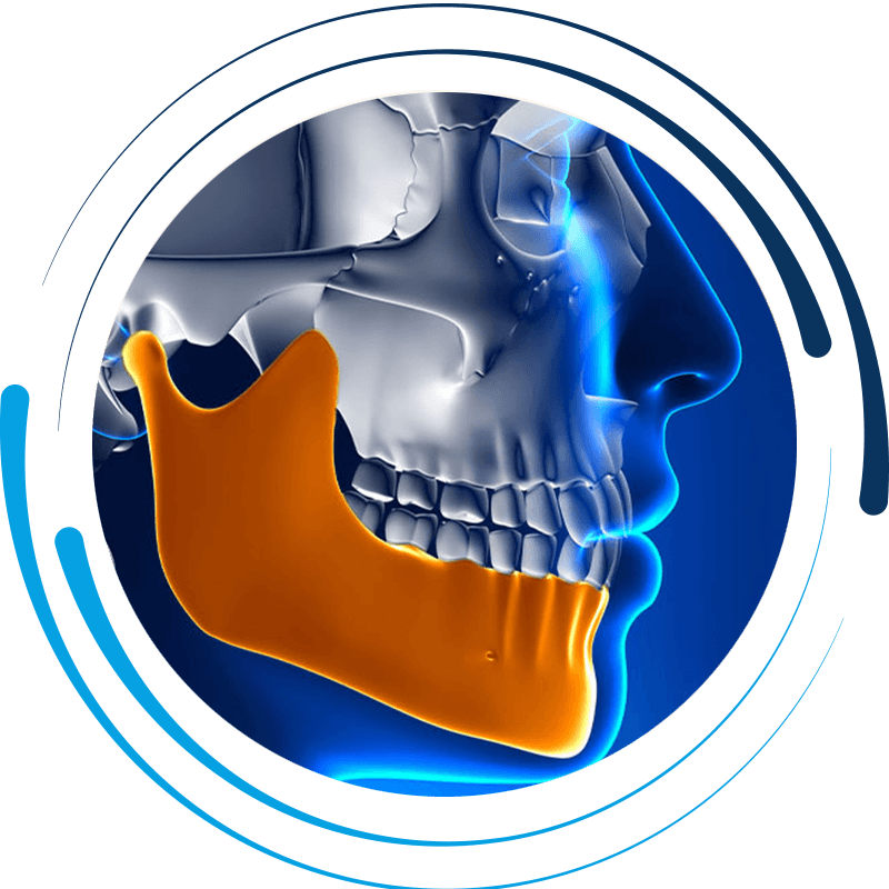 tmj diagram